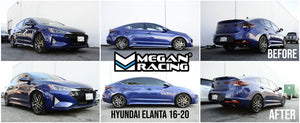 MR-LS-HYE16-Hyundai-Elantra--Lowering-Springs-